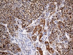 COX17 Monoclonal Antibody (OTI7H5), TrueMAB , OriGene 100 &mu;L; Unconjugated:Antibodies,