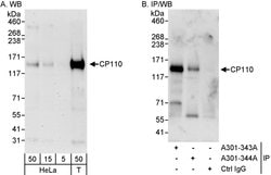 CP110 Rabbit anti-Human, Polyclonal, Bethyl Laboratories 100 &mu;L; Unconjugated:Antibodies,