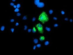 CPA1 (Carboxypeptidase A1) Mouse anti-Human, Clone: OTI4C3, lyophilized,
