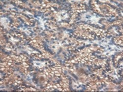 CPA1 (Carboxypeptidase A1) Mouse anti-Human, Clone: OTI4F1, lyophilized,