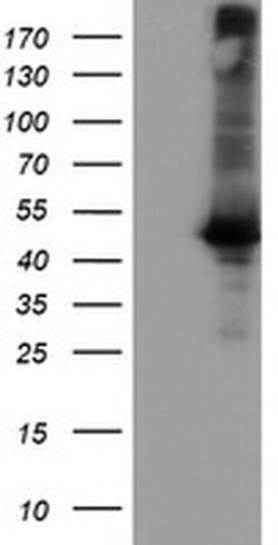 CPA1 (Carboxypeptidase A1) Monoclonal Antibody (OTI1D11), TrueMAB , OriGene