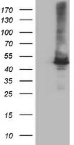 CPA1 (Carboxypeptidase A1) Mouse anti-Human, Clone: OTI1C12, lyophilized,