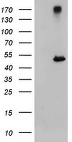 CPA1 (Carboxypeptidase A1) Monoclonal Antibody (OTI4E12), TrueMAB , OriGene:Antibodies:Primary