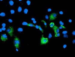 CPA2 Monoclonal Antibody (OTI1A1), TrueMAB , OriGene 30 &mu;L; Unconjugated:Antibodies,