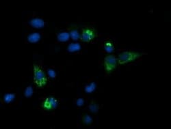 CPA2 Monoclonal Antibody (OTI2E7), TrueMAB , OriGene 100 &mu;L; Unconjugated:Antibodies,