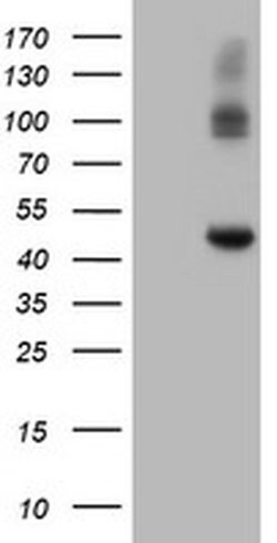 CPA2 Monoclonal Antibody (OTI1C7), TrueMAB , OriGene 100 &mu;L; Unconjugated:Antibodies,
