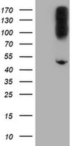 CPA2 Monoclonal Antibody (OTI1A1), TrueMAB , OriGene 30 &mu;L; Unconjugated:Antibodies,