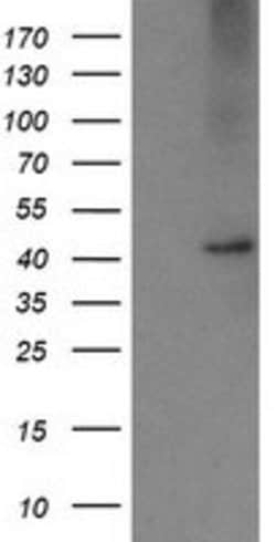 CPA2 Mouse anti-Human, Mouse, Rat, Clone: OTI3D8, lyophilized, TrueMAB