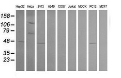 CPA2 Mouse anti-Human, Mouse, Rat, Clone: OTI3D8, lyophilized, TrueMAB