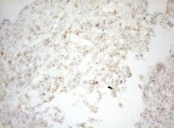 CPM Mouse anti-Human, Clone: OTI2D11, lyophilized, TrueMAB 100 &mu;g; Unconjugated:Antibodies,