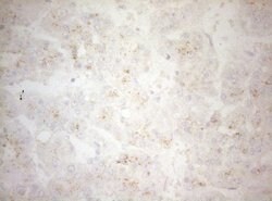 CPM Mouse anti-Human, Clone: OTI2D11, lyophilized, TrueMAB 100 &mu;g; Unconjugated:Antibodies,