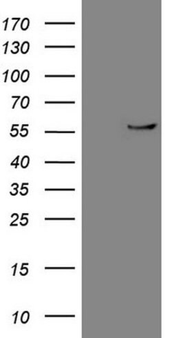 CPM Monoclonal Antibody (OTI8E2), TrueMAB , OriGene 100 &mu;L; Unconjugated:Antibodies,