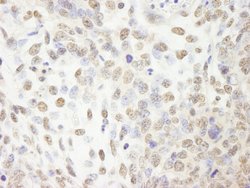CPSF100 Polyclonal Antibody, Bethyl Laboratories 100 &mu;L; Unconjugated:Antibodies,