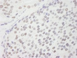 CPSF160 Polyclonal Antibody, Bethyl Laboratories 100 &mu;L; Unconjugated:Antibodies,