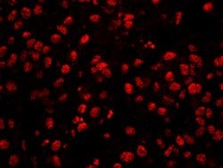 CPSF160 Polyclonal Antibody, Bethyl Laboratories 100 &mu;L; Unconjugated:Antibodies,