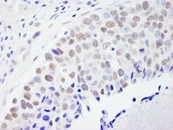 CPSF59 Rabbit anti-Human, Polyclonal, Bethyl Laboratories 100 &mu;L; Unconjugated:Antibodies,