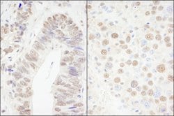 CPSF68 Rabbit anti-Human, Mouse, Polyclonal, Bethyl Laboratories 100 &mu;l;