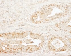 CPSF73 Rabbit anti-Human, Mouse, Polyclonal, Bethyl Laboratories 100 &mu;L;
