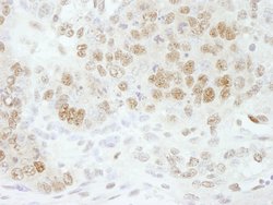 CPSF73 Polyclonal Antibody, Bethyl Laboratories 10 &mu;L; Unconjugated:Antibodies,