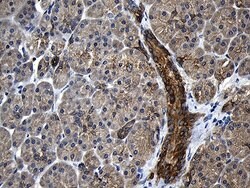 CPT1B Mouse anti-Human, Clone: OTI2A6, lyophilized, TrueMAB 100 &mu;g;