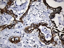 CPT1B Mouse anti-Human, Clone: OTI2A6, lyophilized, TrueMAB 100 &mu;g;