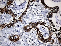 CPT1B Monoclonal Antibody (OTI2A6), TrueMAB , OriGene:Antibodies:Primary