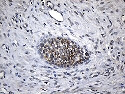 CPT1B Mouse anti-Human, Clone: OTI2A6, lyophilized, TrueMAB 100 &mu;g;