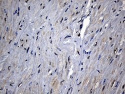 CPT1B Mouse anti-Human, Clone: OTI2A6, lyophilized, TrueMAB 100 &mu;g;