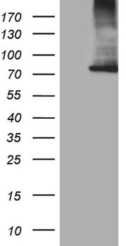 CPT1B Mouse anti-Human, Clone: OTI2A6, lyophilized, TrueMAB 100 &mu;g;