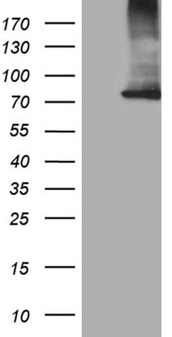 CPT1B Monoclonal Antibody (OTI2A6), TrueMAB , OriGene 30 &mu;L; Unconjugated:Antibodies,