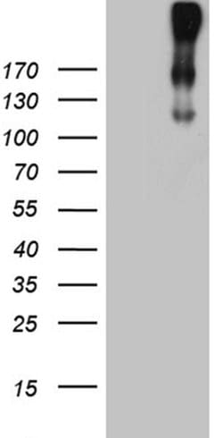 CR1 Monoclonal Antibody (OTI2A8), TrueMAB , OriGene:Antibodies:Primary