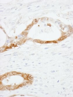 CRABP2 Rabbit anti-Human, Polyclonal, Bethyl Laboratories 100 &mu;L; Unconjugated:Antibodies,