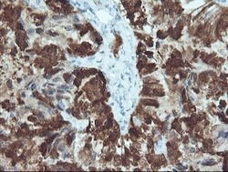 CRABP2 Mouse anti-Human, Clone: OTI10D6, lyophilized, TrueMAB 100 &mu;g;