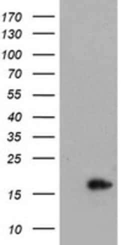CRABP2 Mouse anti-Human, Clone: OTI3C11, lyophilized, TrueMAB 100 &mu;g;