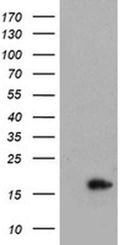 CRABP2 Monoclonal Antibody (OTI3C11), TrueMAB , OriGene:Antibodies:Primary
