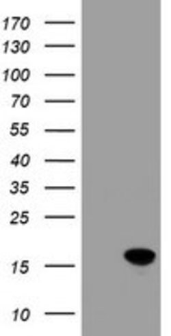 CRABP2 Mouse anti-Human, Clone: OTI10D6, lyophilized, TrueMAB 100 &mu;g;