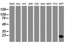CRABP2 Mouse anti-Human, Clone: OTI10D6, lyophilized, TrueMAB 100 &mu;g;
