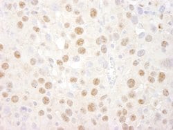 CREB Polyclonal Antibody, Bethyl Laboratories 10 &mu;L | Buy Online | Bethyl Laboratories, Inc | Fisher Scientific