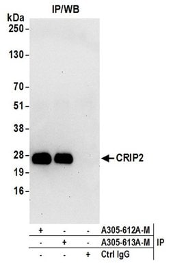 CRIP2 Polyclonal Antibody, Bethyl Laboratories 20 &mu;L; Unconjugated:Antibodies,