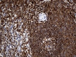 CRLF3 Monoclonal Antibody (OTI2A10), TrueMAB , OriGene 100 &mu;L; Unconjugated:Antibodies,