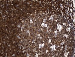 CRLF3 Monoclonal Antibody (OTI2A9), TrueMAB , OriGene 100 &mu;L; Unconjugated:Antibodies,