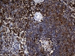 CRLF3 Monoclonal Antibody (OTI2A9), TrueMAB , OriGene 100 &mu;L; Unconjugated:Antibodies,