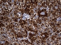 CRLF3 Monoclonal Antibody (OTI2H3), TrueMAB , OriGene 100 &mu;L; Unconjugated:Antibodies,