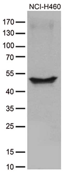 CRLF3 Monoclonal Antibody (OTI2A10), TrueMAB , OriGene 100 &mu;L; Unconjugated:Antibodies,