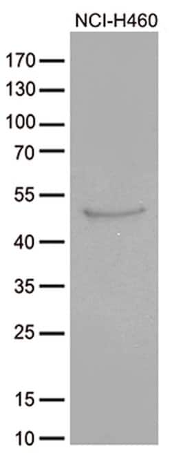CRLF3 Monoclonal Antibody (OTI2A9), TrueMAB , OriGene 100 &mu;L; Unconjugated:Antibodies,