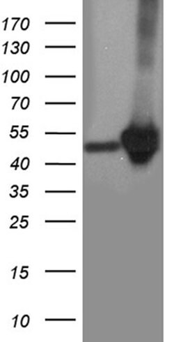 CRLF3 Monoclonal Antibody (OTI4C10), TrueMAB , OriGene 100 &mu;L; Unconjugated:Antibodies,