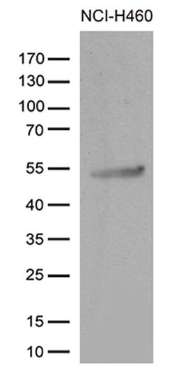 CRLF3 Monoclonal Antibody (OTI4C10), TrueMAB , OriGene:Antibodies:Primary