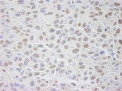 CRM1 Polyclonal Antibody, Bethyl Laboratories:Antibodies:Primary Antibodies