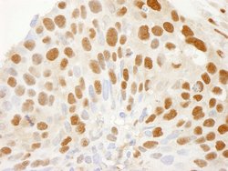 CRM1 Polyclonal Antibody, Bethyl Laboratories 100 &mu;l; Unlabeled:Antibodies,
