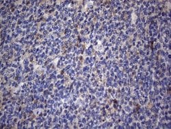 CRP Mouse anti-Human, Clone: OTI4G8, lyophilized, TrueMAB 100 &mu;g; Unconjugated:Antibodies,